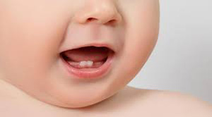 صورة: أسباب تأخر ظهور الأسنان لدى الأطفال