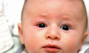 صورة: أسباب و أنواع رأرأة العين عند الأطفال