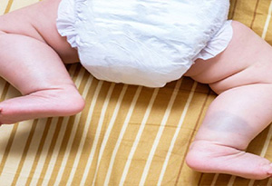 صورة: مراحل تطور الساقين لدى الطفل و تمارين لمساعدته