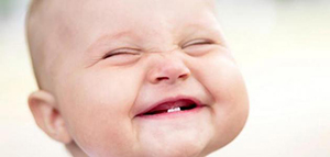 صورة: مشاكل الأسنان عند الأطفال الرضع