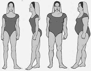 صورة: رجيم الجسم الكظري