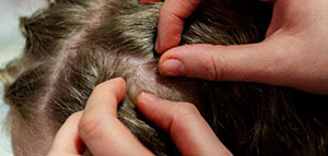 صورة: العلاجات الدوائية و العلاجات المنزلية[d]06