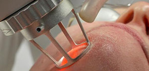 التقشير الكيميائي و الشاي الأخضر والعسل صورة: التقشير الكيميائي و الشاي الأخضر والعسل