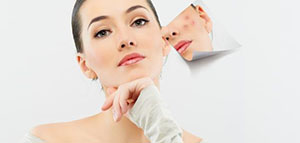 العناية بالبشرة الدهنية و الحليب و وصفة الردة والليمون والخيار صورة: العناية بالبشرة الدهنية و الحليب و وصفة الردة والليمون والخيار