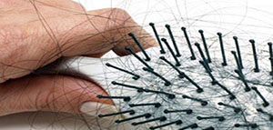 تساقط الشعر و أسباب صحية وطبية لتساقط الشعر صورة: تساقط الشعر و أسباب صحية وطبية لتساقط الشعر