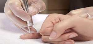 أسباب ظهور الثالول و عوامل خطر الإصابة بالثالول صورة: أسباب ظهور الثالول و عوامل خطر الإصابة بالثالول