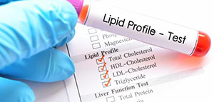 صورة: تحليل HDL و دواعي استخدام تحليل HDL و تعليمات إجراء تحليل HDL
