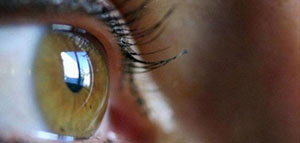 التراخوما صورة: التراخوما