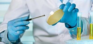 صورة: أسباب الالتهاب في مجرى البول و أعراض الالتهاب في مجرى البول