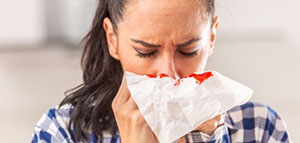 صورة: أسباب شائعة لنزول الدم من الأنف و أسباب غير شائعة لنزول الدم من الأنف