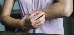 تعريف التهاب الجلد الدهني و أسباب التهاب الجلد الدهني صورة: تعريف التهاب الجلد الدهني و أسباب التهاب الجلد الدهني