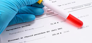 صورة: تحليل الأجسام المضادة للغدة الدرقية و دواعي تحليل الأجسام المضادة للغدة الدرقية