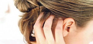 حكة الرأس و أسباب حكة الرأس و علاجات منزلية لحكة الرأس صورة: حكة الرأس و أسباب حكة الرأس و علاجات منزلية لحكة الرأس