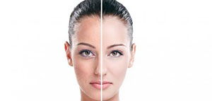 صورة: تبييض الوجه و أفضل الخلطات لتبييض الوجه