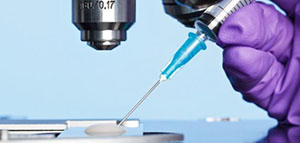 صورة: تحليل سائل الروستاتا و نتائج تحليل البروستاتا