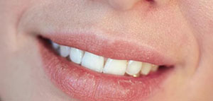 صورة: الشفاه