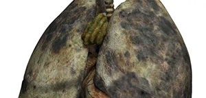 صورة: عصير الخضار الطبيعي و التنفس و تنظيف الرئة من الدخان