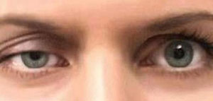 صورة: ماهي الغدة الدرقية تقع الغدة الدرقية في المنطقة الامامية للرقبة اما القصبة الهوا