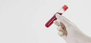 صورة: التعريف الطبي و وسائل تحليل الحمل و كيفية عمل B HCG