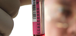 صورة: ارتفاع ضغط الدم و تشخيص ارتفاع ضغط الدم