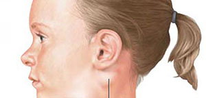 الغدد الليمفاوية و أين تقع الغدد الليمفاوية صورة: الغدد الليمفاوية و أين تقع الغدد الليمفاوية