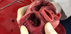 الشرايين صورة: الشرايين