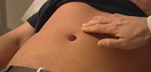 صورة: فيديو عن الفتق السري و الجنب سري