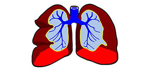صورة: التهاب الشعب الهوائية و أعراض التهاب الشعب الهوائية