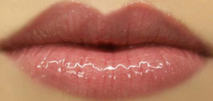 صورة: تصغير الشفاه و وصفات طبيعية لتصغير الشفايف