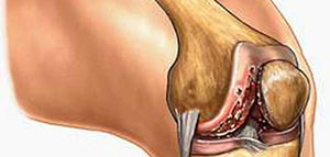 صورة: الرباط