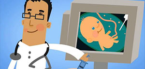 صورة: فحص السائل المحيط بالجنين و دواعي إجراء فحص السائل المحيط بالجنين