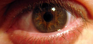 صورة: الفيروسات و البكتيريا و الحساسية و المهيجات الخارجية