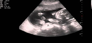 صورة: تشخيص الامراض الوراثية عند الجنين و أسباب تستدعي عمل الاختبارات الجينية