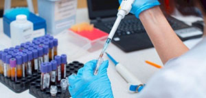 تحليل المعادن الثقيلة في الجسم صورة: تحليل المعادن الثقيلة في الجسم