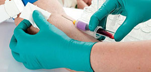 صورة: اختبار الوظائف الكلوية و التصوير الاشعاعي