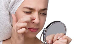 صورة: الرؤوس السوداء و طرق إزالة الرؤوس السوداء طبيعيا