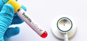 صورة: طرق انتقال مرض الزهري و أعراض مرض الزهري