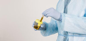 صورة: الحرقان في مجرى البول و أسباب الحرقان في مجرى البول