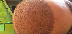 صورة: العناية بالشعر و الأدوية و النظام الغذائي