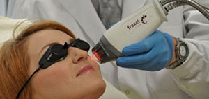 صورة: كيف يتم علاج حب الشباب بالليزر و كم جلسة ليزر قد أحتاج لعلاج حب الشباب