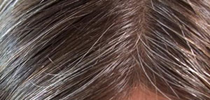 صورة: الشيب و وصفات طبيعية لإزالة الشيب نهائيا