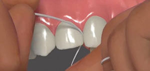 صورة: ما بعد تقويم الأسنان و مخاطر ما بعد تقويم الأسنان