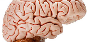 صورة: الدماغ و ضمور المخ و أعراض ضمور المخ